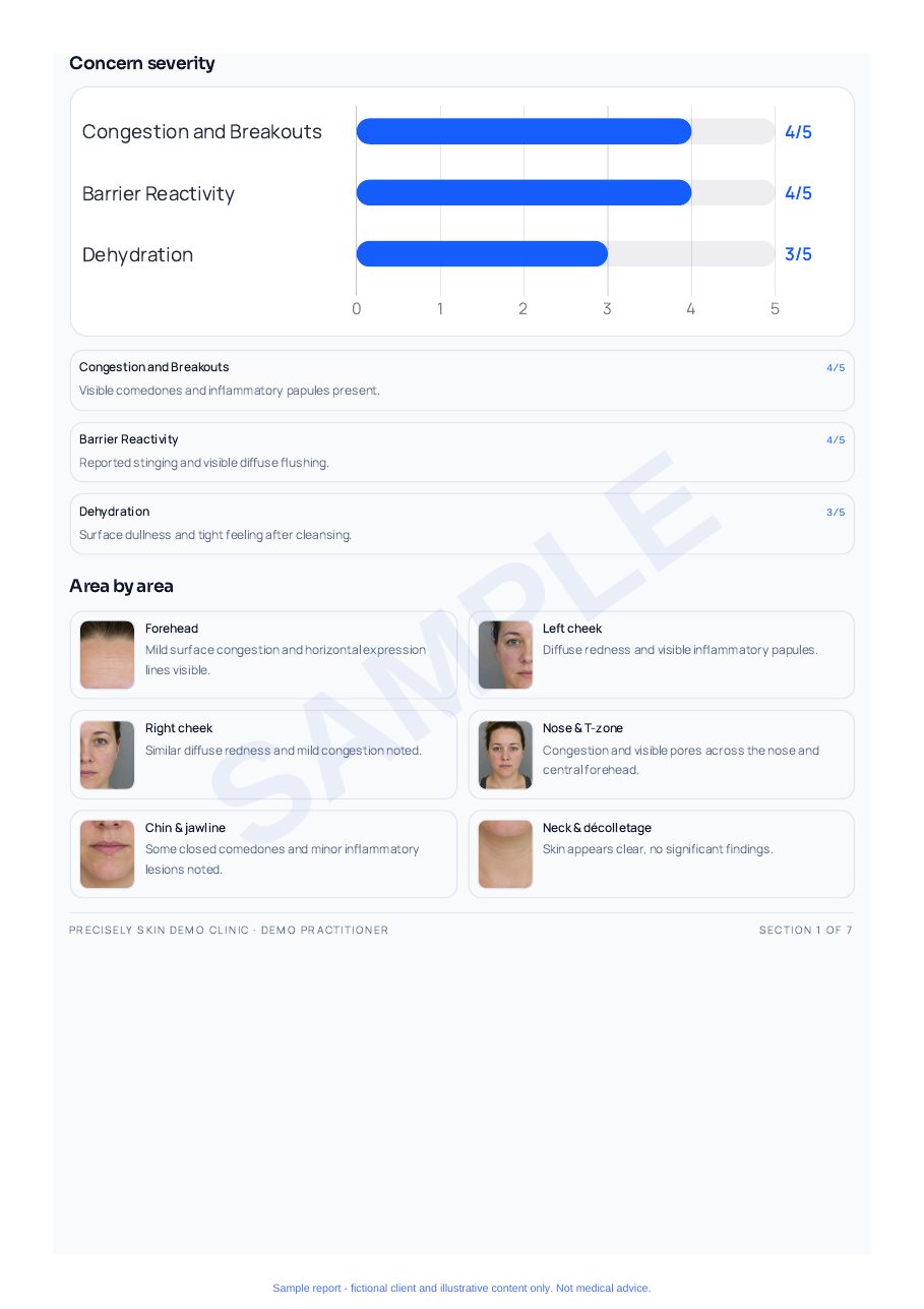 Sample skin report page — Concern severity by area